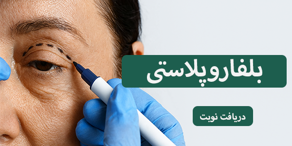 مزایای بلفارو