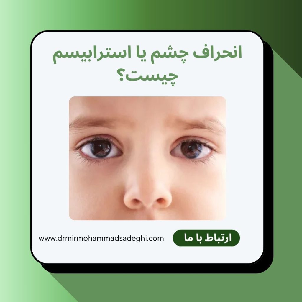 انحراف چشم