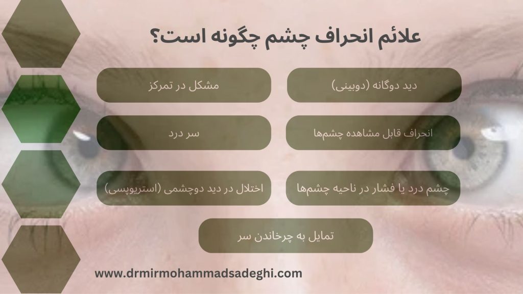 انحراف چشم