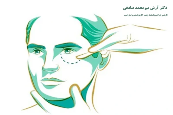 ویژگی های بهترین جراح بلفاروپلاستی