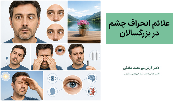 علائم انحراف چشم در بزرگسالان