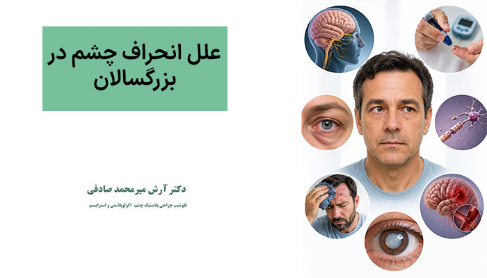 علل انحراف چشم در بزرگسالان