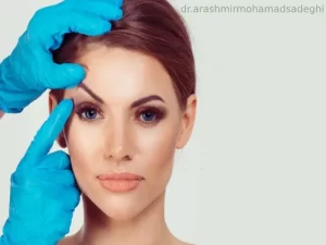 اقدامات قبل از بلفاروپلاستی