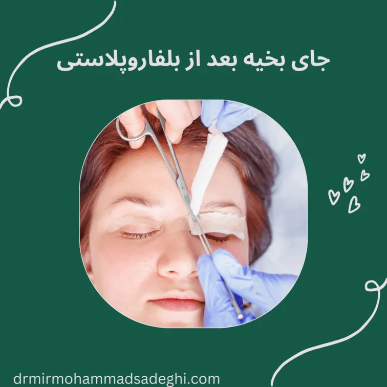 جای بخیه بعد از بلفاروپلاستی