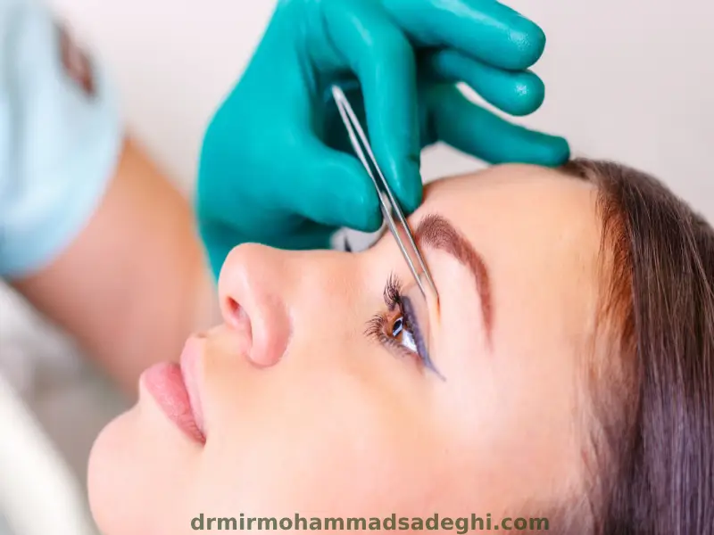 جای بخیه بعد از بلفاروپلاستی