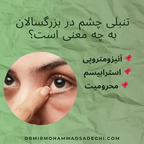 تنبلی چشم در بزرگسالان