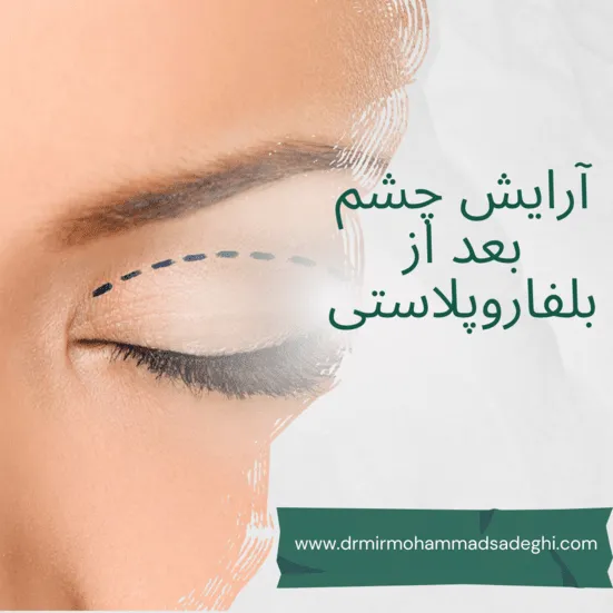 آرایش چشم بعد از بلفاروپلاستی