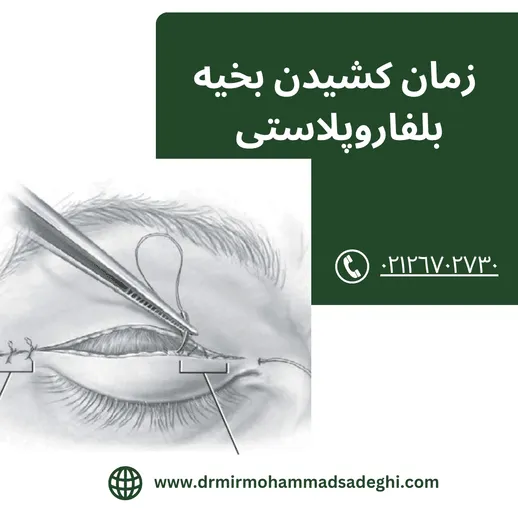 زمان کشیدن بخیه بلفاروپلاستی