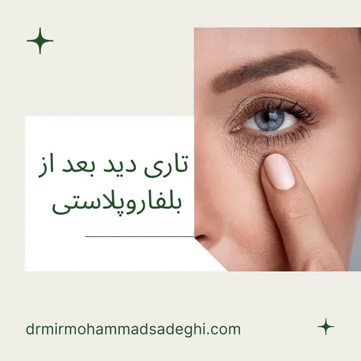 تاری دید بعد از بلفاروپلاستی