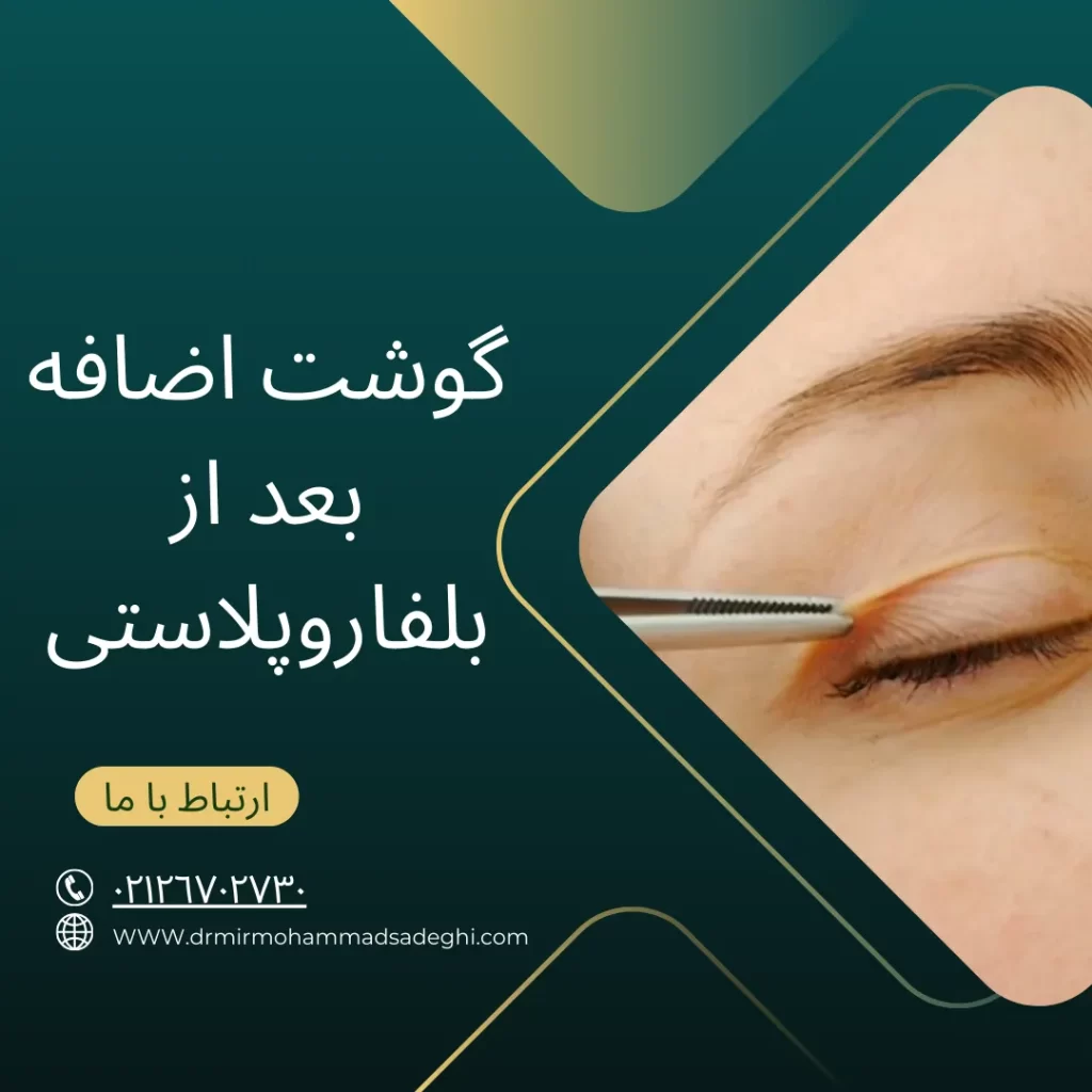 گوشت اضافه بعد از بلفاروپلاستی