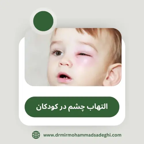 التهاب چشم در کودکان