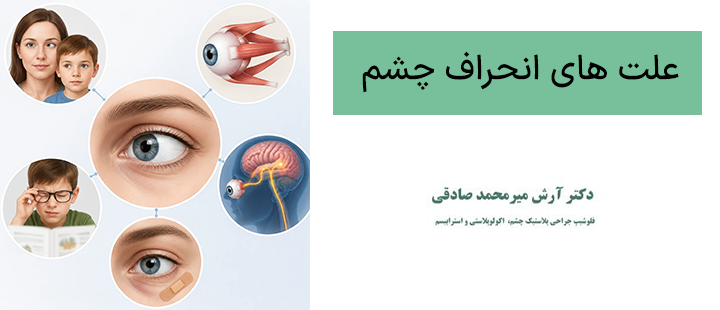 علت های انحراف چشم