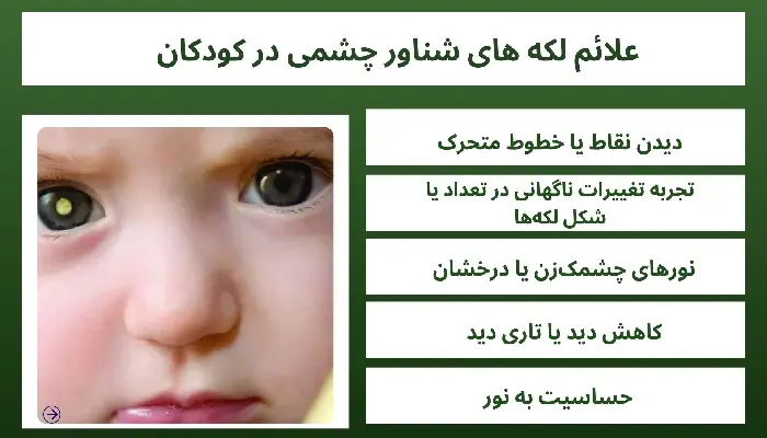 لکه های شناور چشمی در کودکان