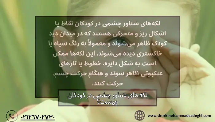 لکه های شناور چشمی
