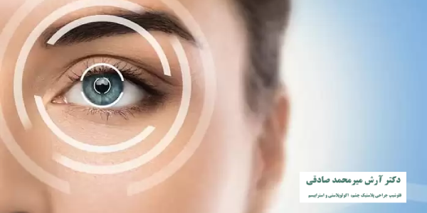 تفاوت عمل لیزیک و لازک