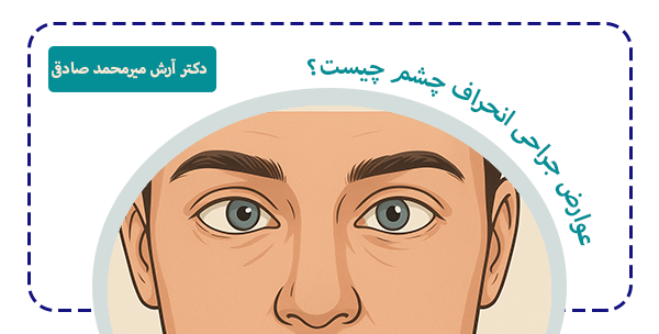 علت عوارض انجراف چشم