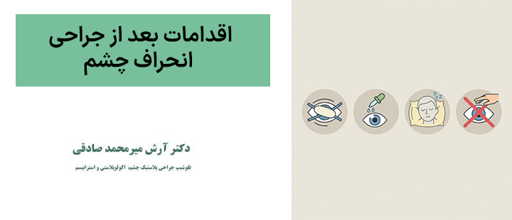 اقدامات بعد از جراحی انحراف چشم