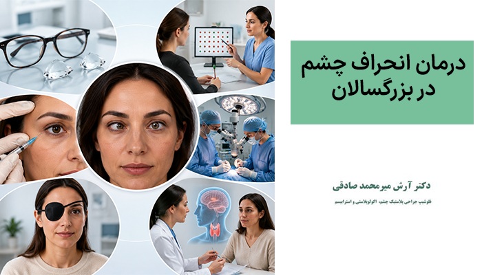 درمان انحراف چشم در بزرگسالان