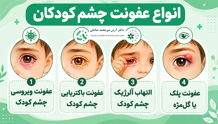 عفونت چشم کودکان چه انواعی دارد؟