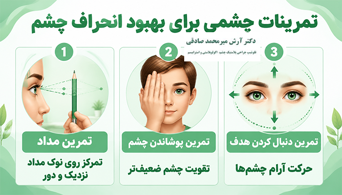 تمرینات چشمی برای بهبود انحراف چشم