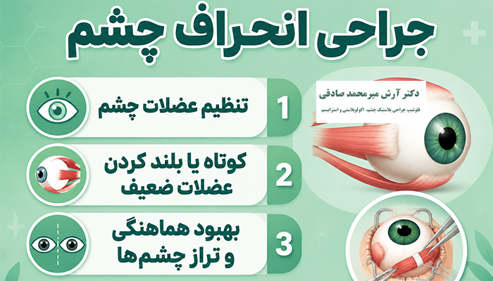 جراحی انحراف چشم