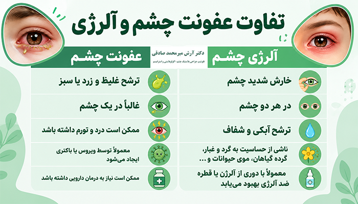 تفاوت عفونت چشم و آلرژی